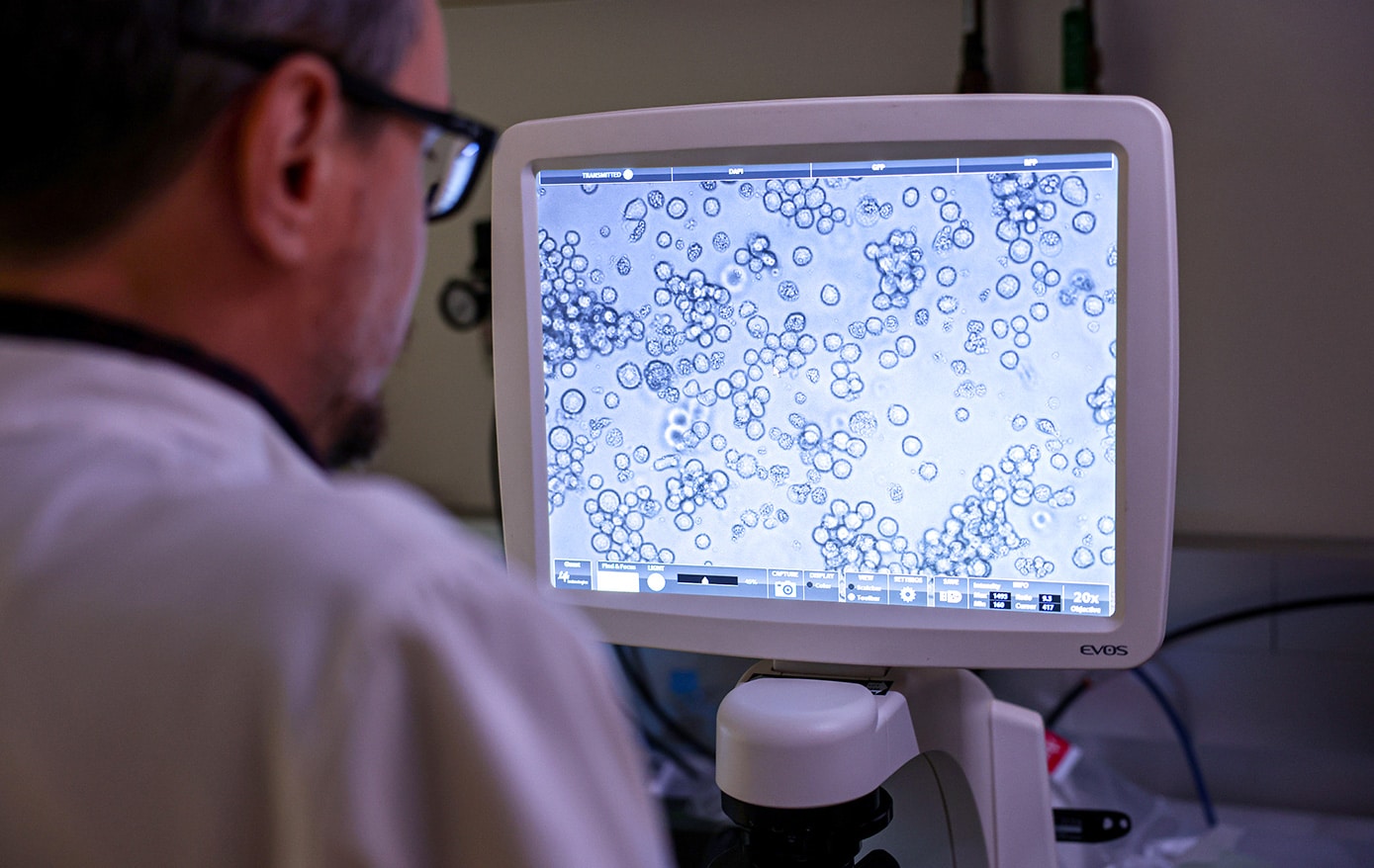 A scientist views a screen showing a microscope photo of cells dyed blue