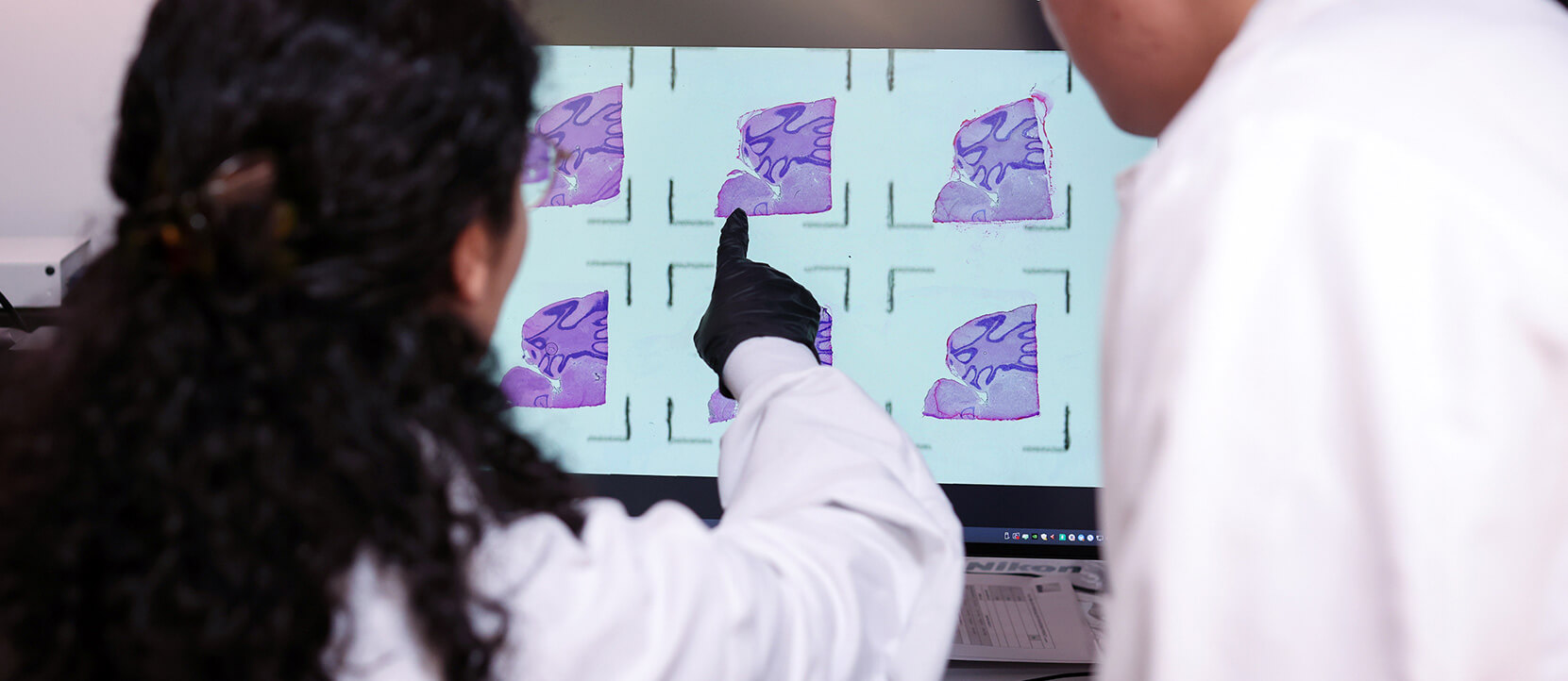 A scientist points at slide sections on a screen which are dyed purple