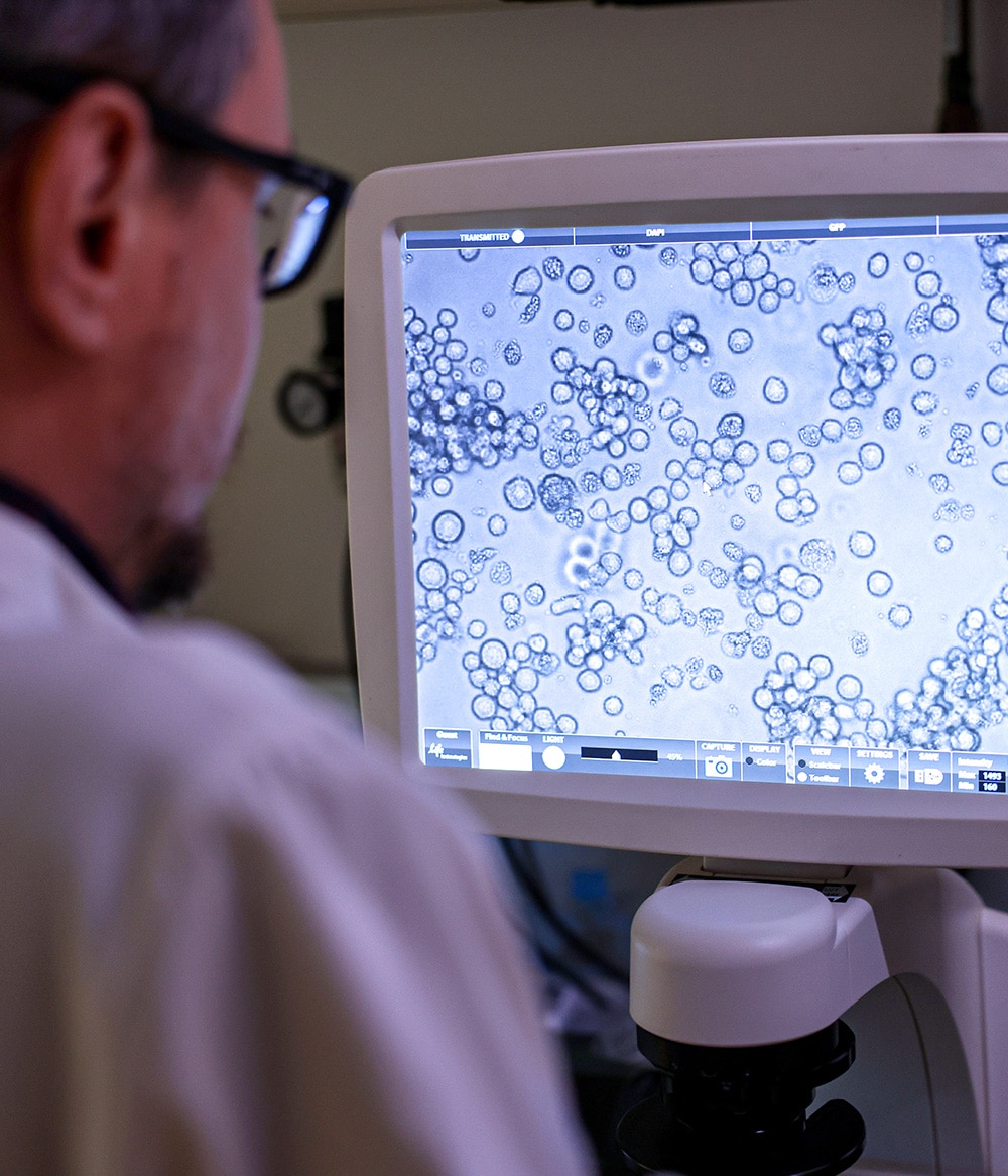 A scientist views a screen showing a microscope photo of cells dyed blue