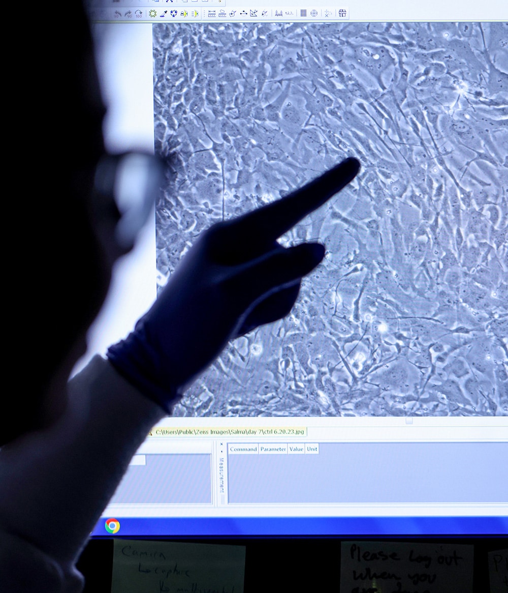 A scientist points at a microscope image